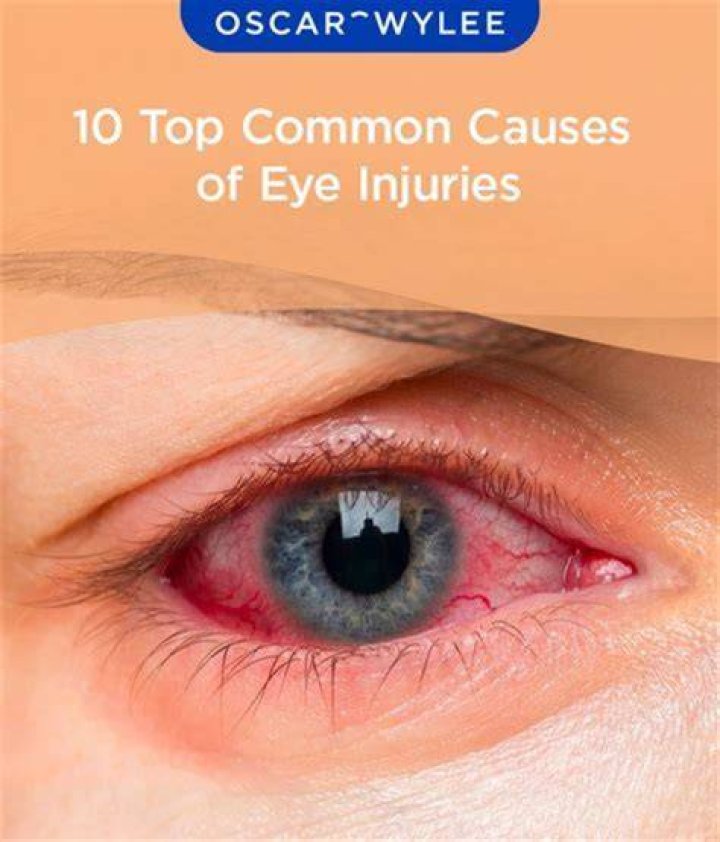 Anthony Zerbe Eye Injury: A Comprehensive Analysis and Updates