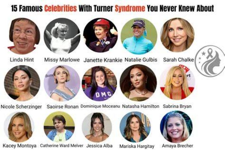 Celebrities Who Inspire: A Look at Turner Syndrome