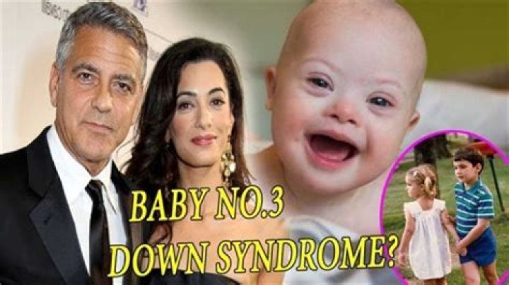 Does George Clooney Have a Down Syndrome Child?