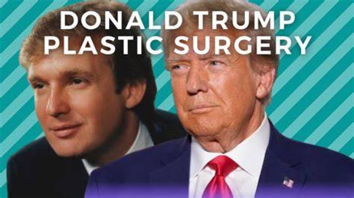 Donald Trump and Plastic Surgery: Unveiling the Truth Behind the Rumors