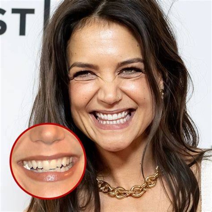 Exploring the Charm of Actresses with Gaps in Their Teeth