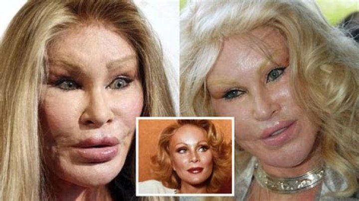 Exploring the Transformation: Jocelyn Wildenstein Before Surgery