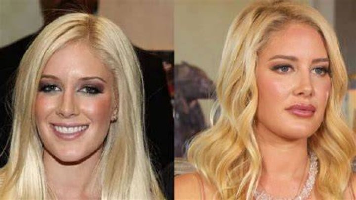 Heidi Montag Before Surgery: A Glimpse Into Her Past