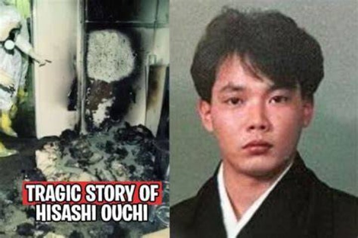 Hisashi Ouchi Body Photo: The Tragic Story Behind the Image