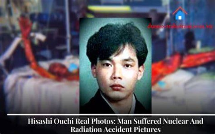 Hisashi Ouchi: The Real Picture of a Tragic Nuclear Accident Victim