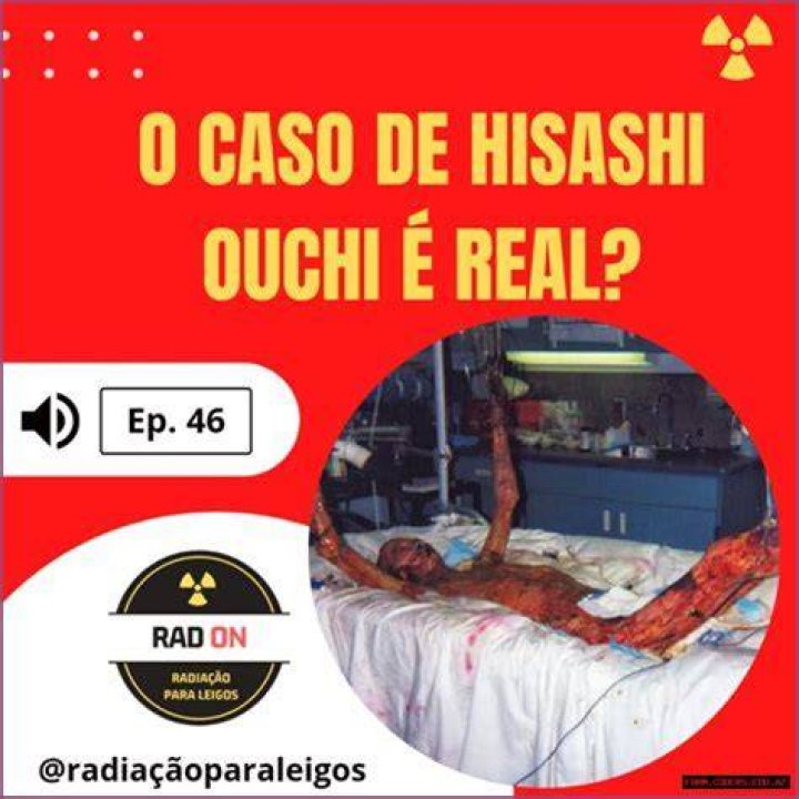 Hisashi Real Photos: Unveiling the Authenticity Behind the Lens