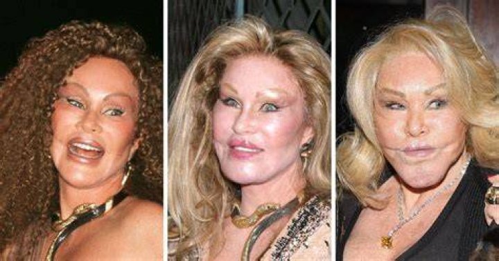 Jocelyn Wildenstein: A Journey Through Time and Transformation