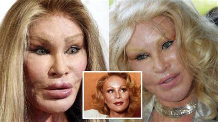 Jocelyn Wildenstein Before Surgeries: The Transformation of a Controversial Icon