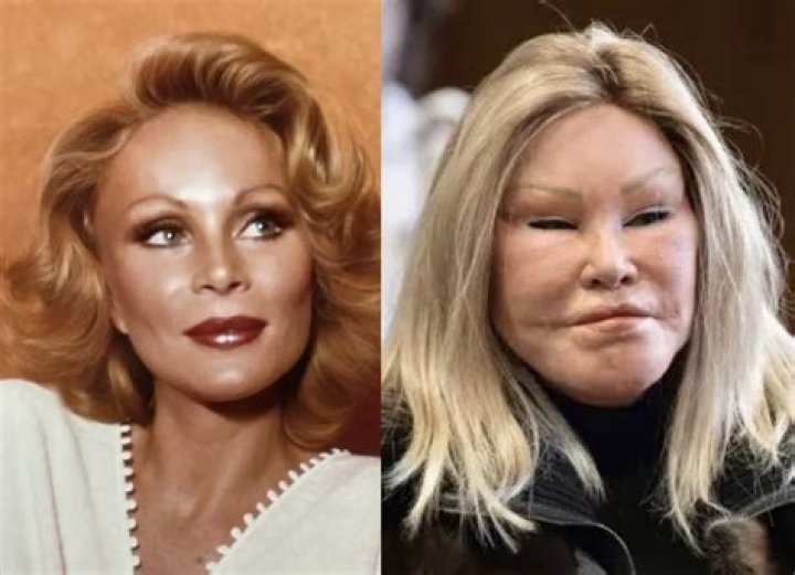 Jocelyn Wildenstein: The Enigmatic Transformation Before Plastic Surgery