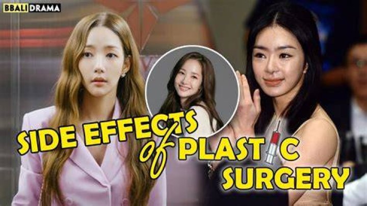 Kim Soo Hyun Face Surgery: Unveiling the Truth Behind the Transformation