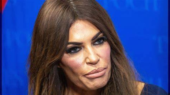 Kimberly Guilfoyle's Face Work: An In-Depth Look at Her Beauty Transformations