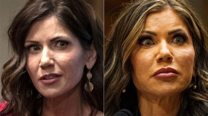 Kristi Noem Face Work: An In-Depth Look at the Governor’s Cosmetic Enhancements