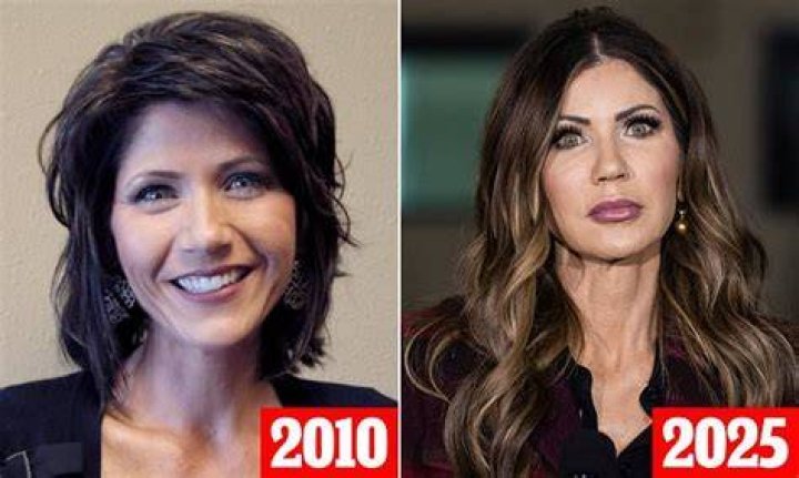 Kristi Noem Facelift: Exploring the Transformation and Public Reaction