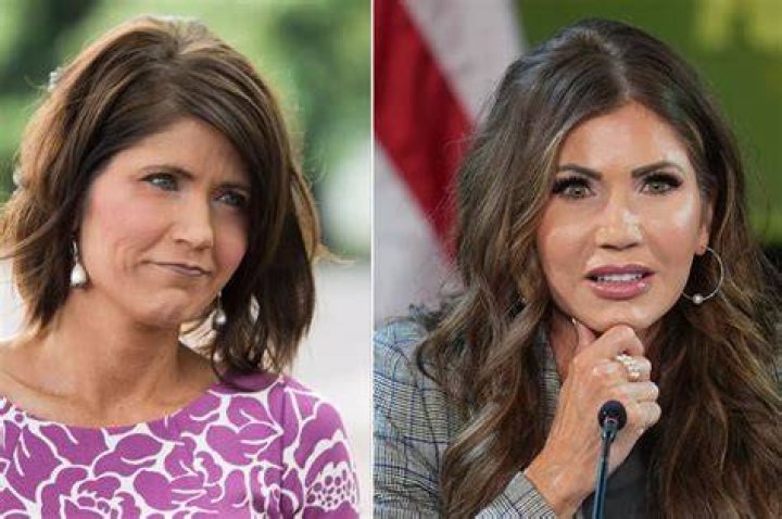 Kristi Noem's Cosmetic Surgery: A Comprehensive Overview