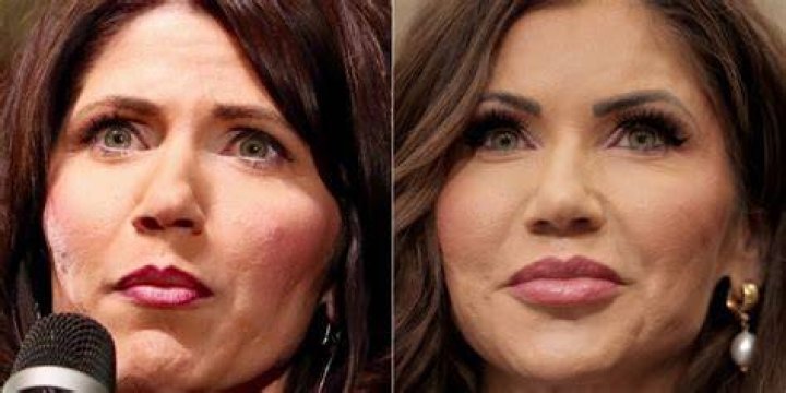 Kristy Noem Plastic Surgery: Everything You Need to Know