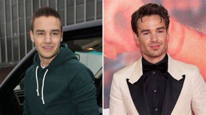 Liam Payne's Jaw: The Enigmatic Feature of a Pop Star