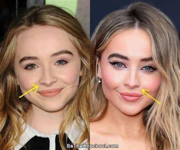 Sabrina Carpenter Nose: The Evolution of Her Look