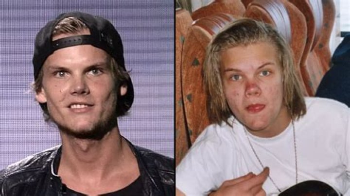 The Shocking Truth: Why Did Avicii Tragically Lose His Life?