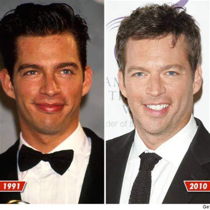 Understanding Harry Connick Jr.'s Stroke: A Deep Dive