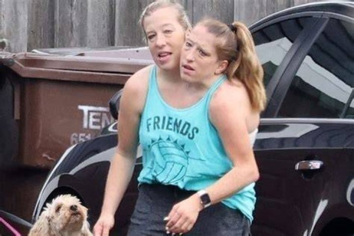 Unraveling the Mystery of Abby and Brittany Hensel Family Tragedy