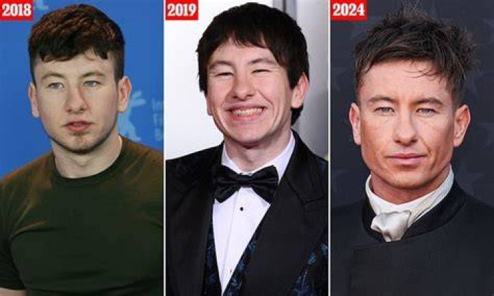Unraveling the Mystery of Barry Keoghan Surgery