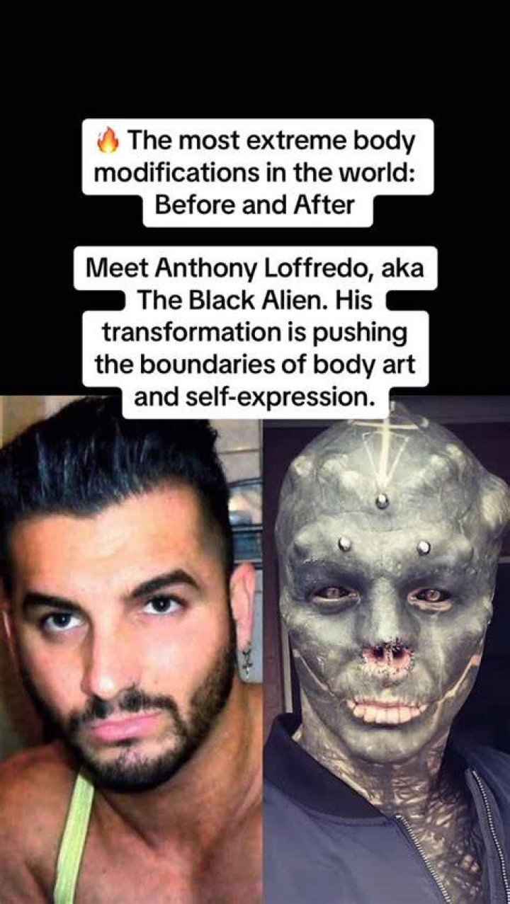 Unveiling the Enigma of Anthony Loffredo: The Man Behind the Transformation
