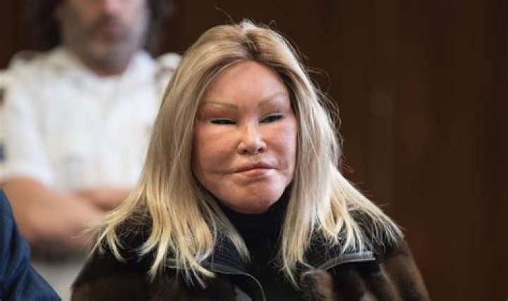 Unveiling the Life of Jocelyne Wildenstein: The Catwoman of New York