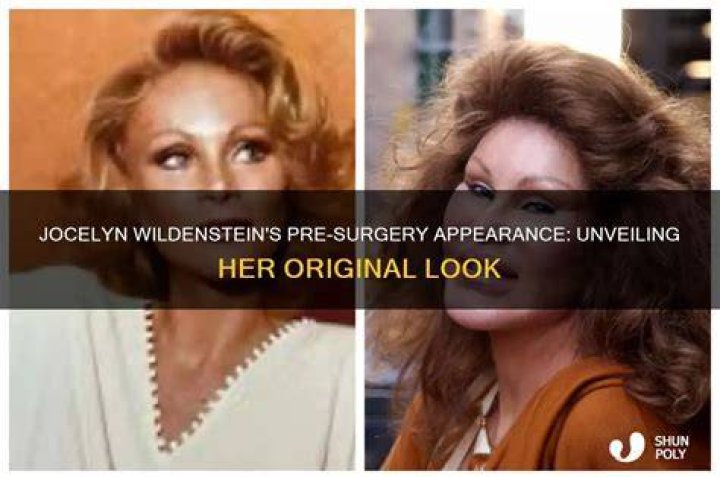 Unveiling the Mystique: Jocelyne Wildenstein Before Surgery