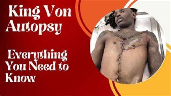 Where Was King Von Shot Autopsy: A Comprehensive Analysis