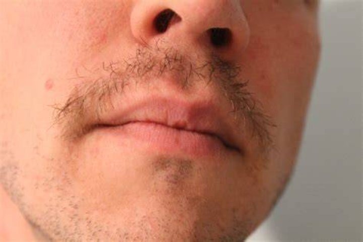 Why Is My Mustache Not Growing Thick?